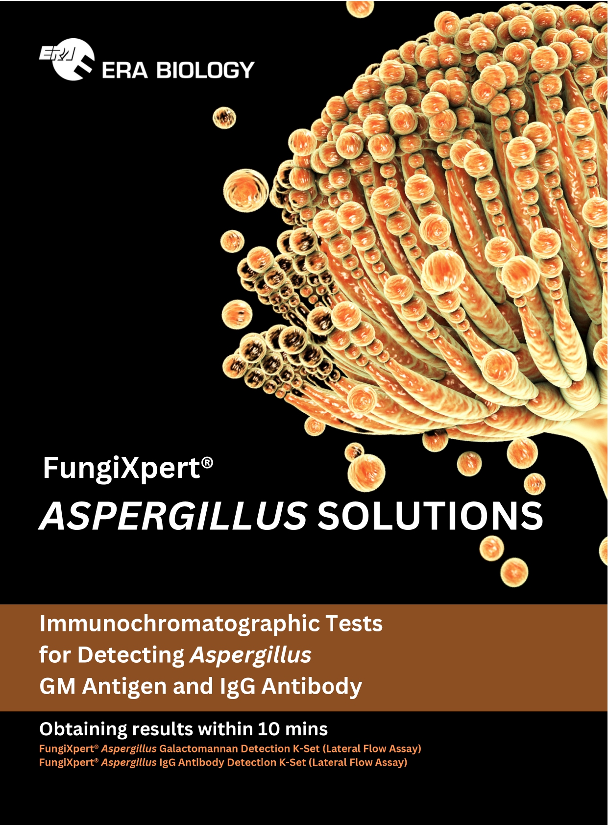 FungiXpert® <em>Aspergillus</em> Galactomannan Detection K-Set (Lateral Flow Assay)